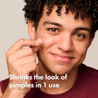 Man wearing a Mighty Patch pimple patch on his cheek